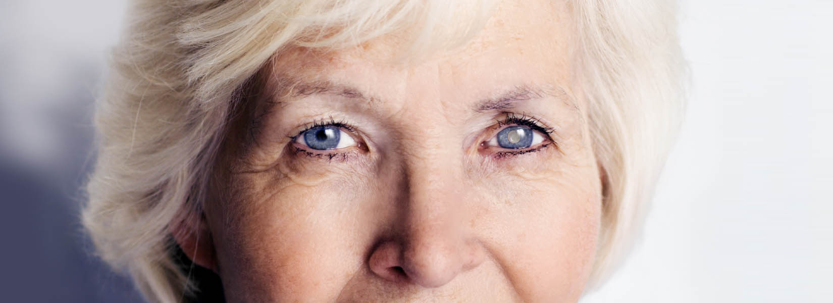 Cataract Surgery in South Columbus